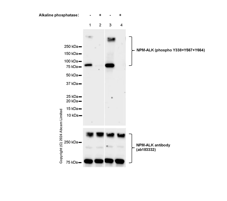 Western blot - Anti-ALK (phospho Y1278 + Y1507 + Y1604) antibody [RM1164] (AB322000)