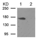 Western blot - Anti-ALK (phospho Y1507) antibody (AB192809)