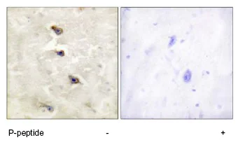 Immunohistochemistry (Formalin/PFA-fixed paraffin-embedded sections) - Anti-ALK (phospho Y1507) antibody (AB73996)