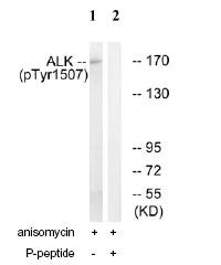 Western blot - Anti-ALK (phospho Y1507) antibody (AB73996)