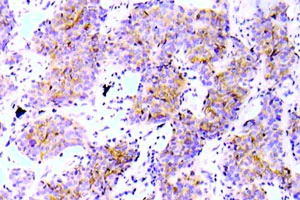 Immunohistochemistry (Formalin/PFA-fixed paraffin-embedded sections) - Anti-ALK (phospho Y1586) antibody (AB139139)
