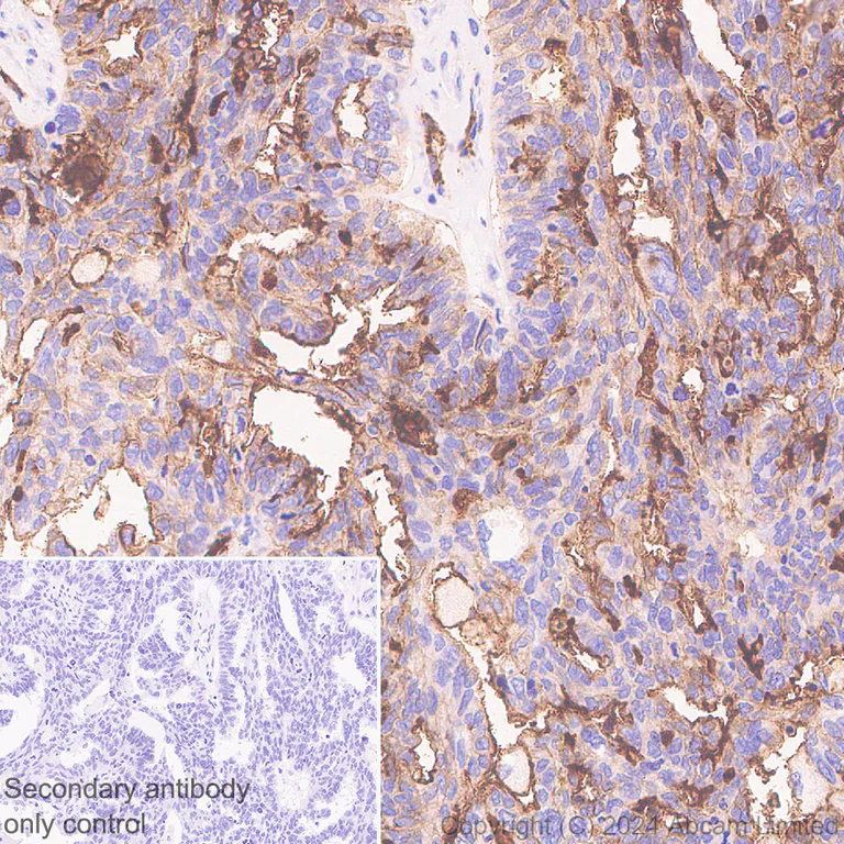 Immunohistochemistry (Formalin/PFA-fixed paraffin-embedded sections) - Anti-Alkaline Phosphatase antibody [EPR20428-147] - BSA and Azide free (Capture) (AB252581)