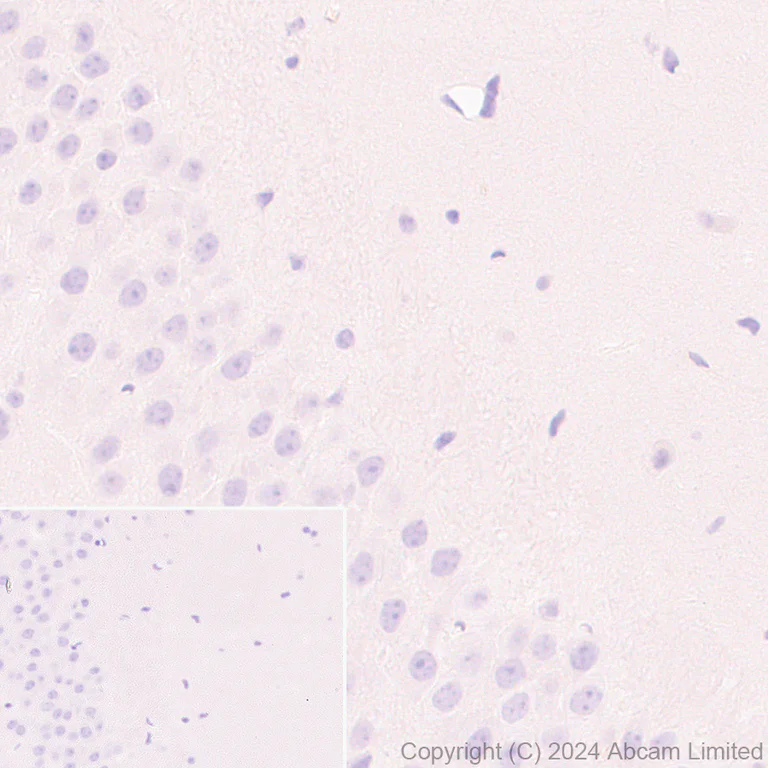 Immunohistochemistry (Formalin/PFA-fixed paraffin-embedded sections) - Anti-Alkaline Phosphatase antibody [EPR20428-147] - BSA and Azide free (Capture) (AB252581)