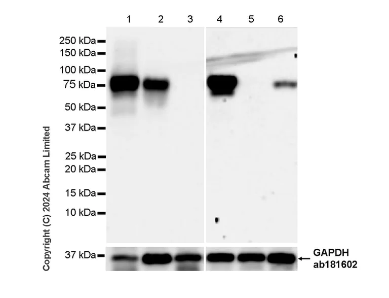 Western blot - Anti-Alkaline Phosphatase antibody [EPR20428-147] - BSA and Azide free (Capture) (AB252581)