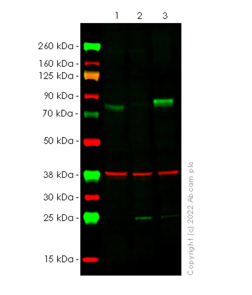 Western blot - Anti-Alkaline Phosphatase antibody [EPR27506-72] (AB305305)