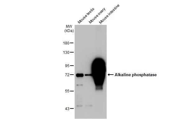 Western blot - Anti-Alkaline phosphatase antibody [HL1267] (AB308353), expandable thumbnail