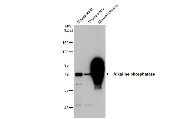 Western blot - Anti-Alkaline phosphatase antibody [HL1267] (AB308353)