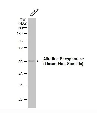 Western blot - Anti-Alkaline Phosphatase antibody [HL2003] (AB317123)