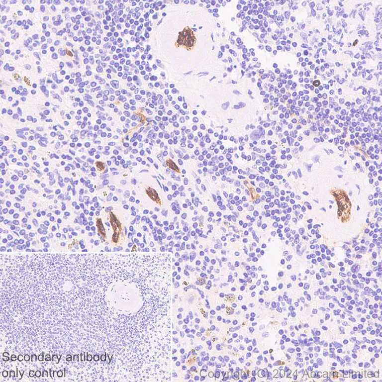 Immunohistochemistry (Formalin/PFA-fixed paraffin-embedded sections) - Anti-Alkaline Phosphatase antibody [RM1283] (AB322533)