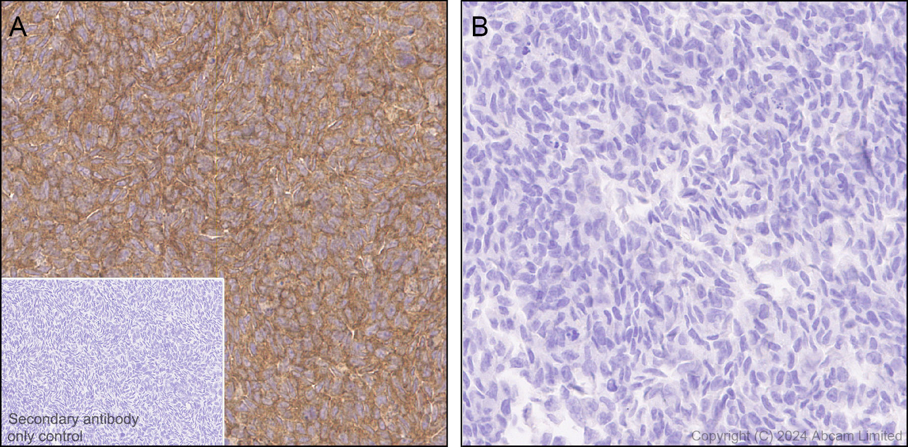 Immunohistochemistry (Formalin/PFA-fixed paraffin-embedded sections) - Anti-Alkaline Phosphatase antibody [RM1283] (AB322533), expandable thumbnail