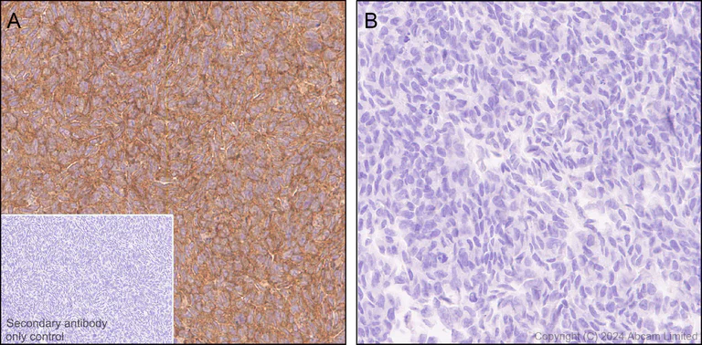 Immunohistochemistry (Formalin/PFA-fixed paraffin-embedded sections) - Anti-Alkaline Phosphatase antibody [RM1283] (AB322533)