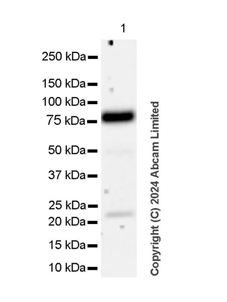 Western blot - Anti-Alkaline Phosphatase antibody [RM1283] (AB322533)