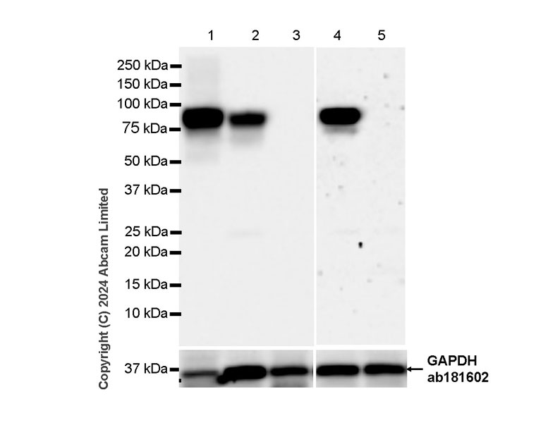 Western blot - Anti-Alkaline Phosphatase antibody [RM1283] (ab322533), expandable thumbnail