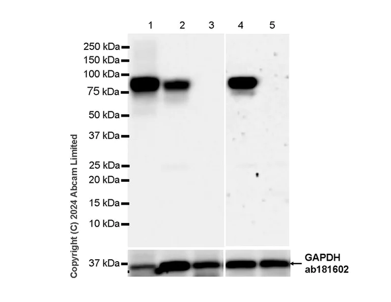 Western blot - Anti-Alkaline Phosphatase antibody [RM1283] (AB322533)