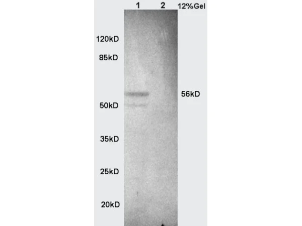 Western blot - Anti-Alkaline Phosphatase, Tissue Non-Specific antibody (AB203106)