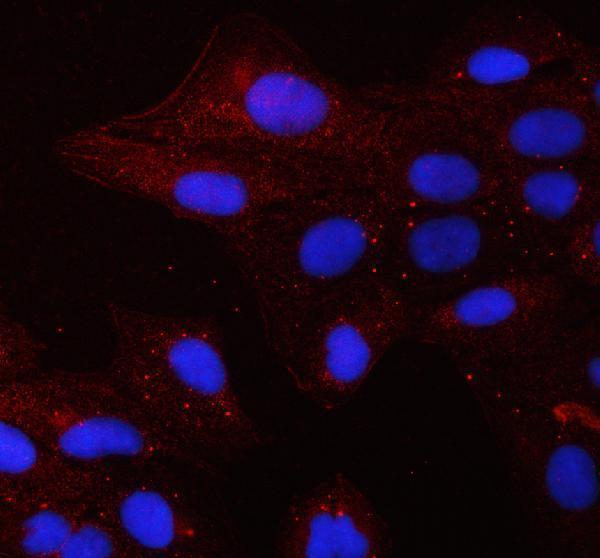 Immunocytochemistry/ Immunofluorescence - Anti-Alkaline Phosphatase, Tissue Non-Specific antibody (AB65834)