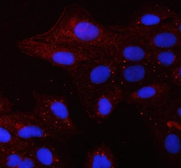 Immunocytochemistry/ Immunofluorescence - Anti-Alkaline Phosphatase, Tissue Non-Specific antibody (AB65834)