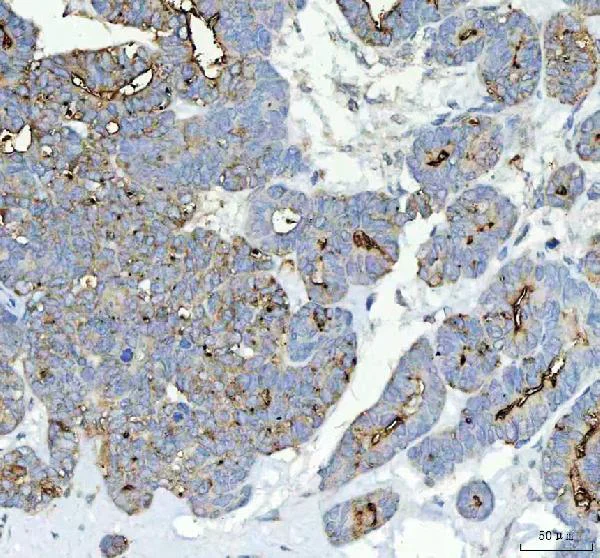 Immunohistochemistry (Formalin/PFA-fixed paraffin-embedded sections) - Anti-Alkaline Phosphatase, Tissue Non-Specific antibody (AB65834)