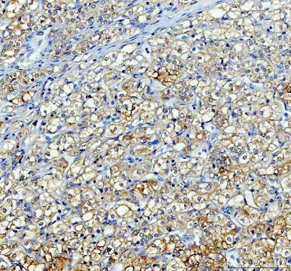 Immunohistochemistry (Formalin/PFA-fixed paraffin-embedded sections) - Anti-Alkaline Phosphatase, Tissue Non-Specific antibody (AB65834)