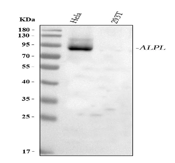 Western blot - Anti-Alkaline Phosphatase, Tissue Non-Specific antibody (AB65834)