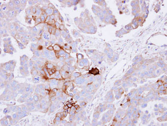 Immunohistochemistry (Formalin/PFA-fixed paraffin-embedded sections) - Anti-Alkaline Phosphatase, Tissue Non-Specific antibody (AB97384), expandable thumbnail