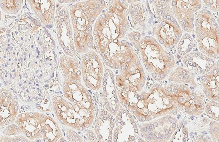 Immunohistochemistry (Formalin/PFA-fixed paraffin-embedded sections) - Anti-Alkaline Phosphatase, Tissue Non-Specific antibody (AB97384)