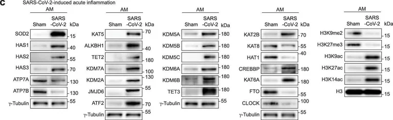 Western blot - Anti-ALKBH1 antibody [EPR19215] (AB195376)