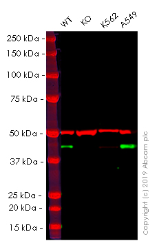 Anti-ALKBH1 antibody [EPR6175(2)]