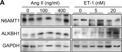 Western blot - Anti-ALKBH1 antibody [EPR6176] (AB126596)