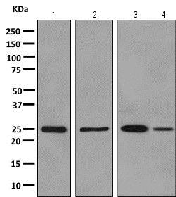 Western blot - Anti-ALKBH2 antibody [EPR6177(2)] (AB154859), expandable thumbnail