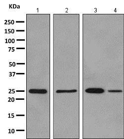 Western blot - Anti-ALKBH2 antibody [EPR6177(2)] - BSA and Azide free (AB243917)