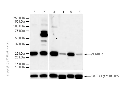 Western blot - Anti-ALKBH2 antibody [EPR6177(2)] - BSA and Azide free (AB243917)