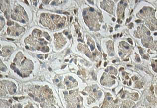 Immunohistochemistry (Formalin/PFA-fixed paraffin-embedded sections) - Anti-ALKBH4 antibody (AB113500), expandable thumbnail