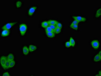 Immunocytochemistry/ Immunofluorescence - Anti-ALKBH4 antibody (AB234802)