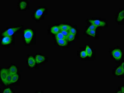 Immunocytochemistry/ Immunofluorescence - Anti-ALKBH4 antibody (AB234802)