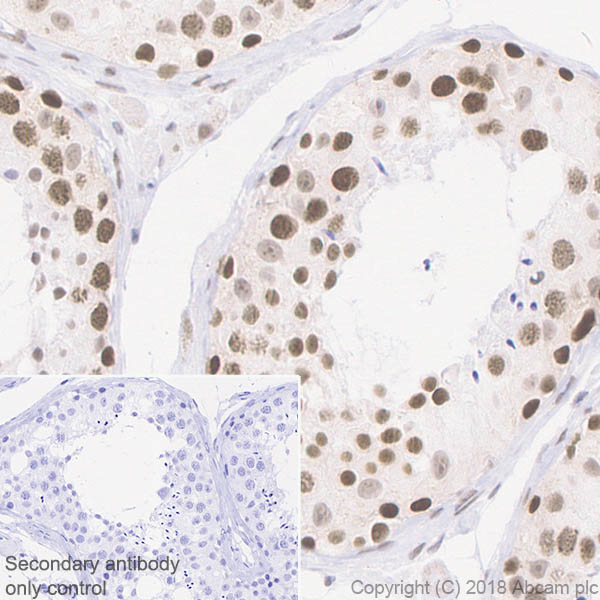 Immunohistochemistry (Formalin/PFA-fixed paraffin-embedded sections) - Anti-ALKBH5 antibody [EPR18958] (AB195377), expandable thumbnail