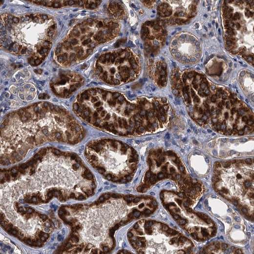 Immunohistochemistry (Formalin/PFA-fixed paraffin-embedded sections) - Anti-ALKBH7 antibody (AB204568), expandable thumbnail