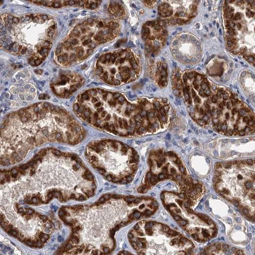 Immunohistochemistry (Formalin/PFA-fixed paraffin-embedded sections) - Anti-ALKBH7 antibody (AB204568)