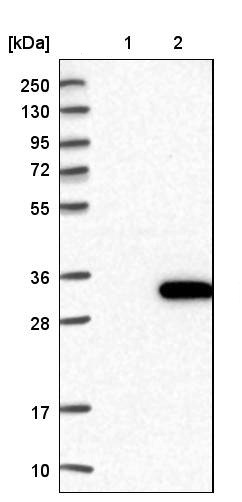 Western blot - Anti-ALKBH7 antibody (AB204568), expandable thumbnail