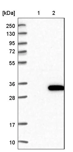 Western blot - Anti-ALKBH7 antibody (AB204568)