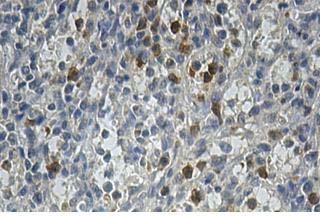 Immunohistochemistry (Formalin/PFA-fixed paraffin-embedded sections) - Anti-ALKBH8 antibody (AB113512)