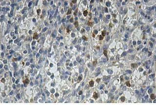 Immunohistochemistry (Formalin/PFA-fixed paraffin-embedded sections) - Anti-ALKBH8 antibody (AB113512)