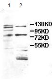 Western blot - Anti-ALKBH8 antibody (AB113512)
