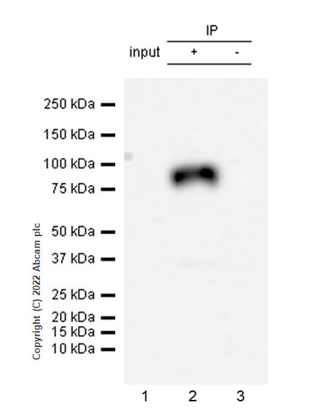 Immunoprecipitation - Anti-ALK(pY1278) antibody [EPR26945-22] (AB305099), expandable thumbnail