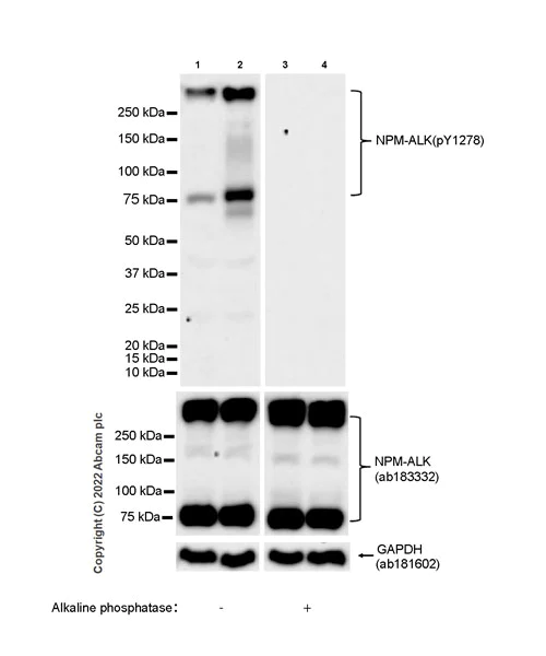 Western blot - Anti-ALK(pY1278) antibody [EPR26945-22] (AB305099)