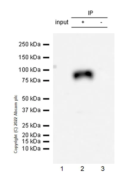 Immunoprecipitation - Anti-ALK(pY1278) antibody [EPR26945-22] - BSA and Azide free (AB305068)