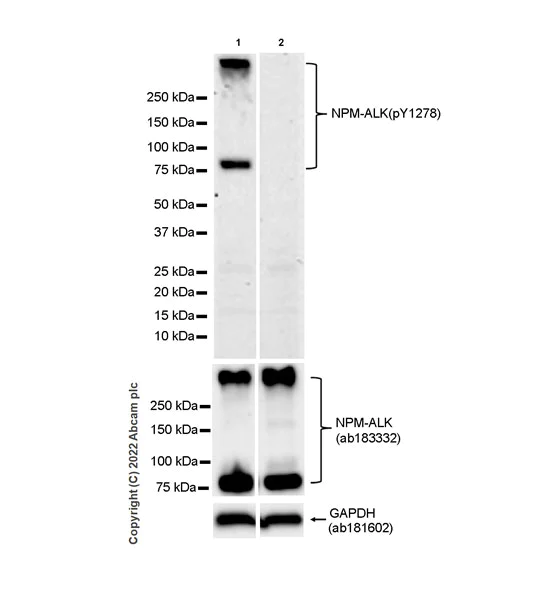 Western blot - Anti-ALK(pY1278) antibody [EPR26945-22] - BSA and Azide free (AB305068)
