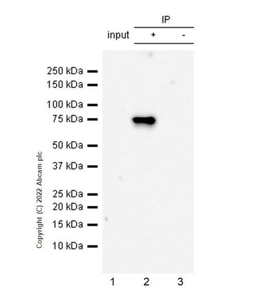 Immunoprecipitation - Anti-ALK(pY1507) antibody [EPR26946-33] (AB305098)
