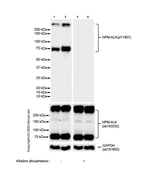Western blot - Anti-ALK(pY1507) antibody [EPR26946-33] (AB305098)