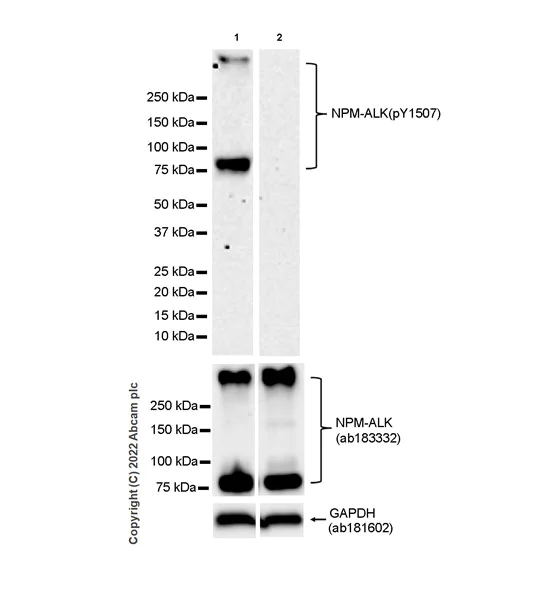 Western blot - Anti-ALK(pY1507) antibody [EPR26946-33] (AB305098)